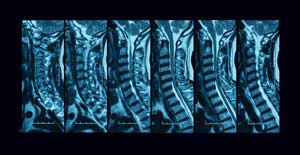 spine-xray-image